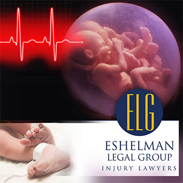 Mirena Birth Control Defects Lawsuit, Eshelman Legal Group